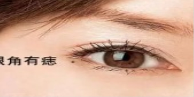 泪痣的位置与命运图是什么