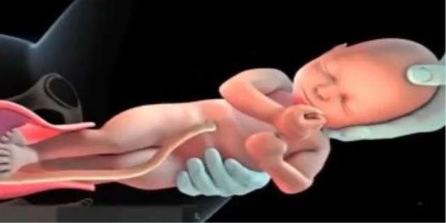 生孩子顺产正面