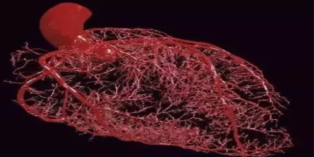 女性心肌缺血的原因