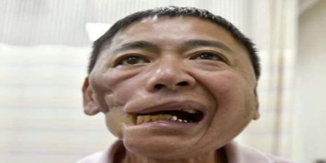 男人吃槟榔对性功能有害处吗